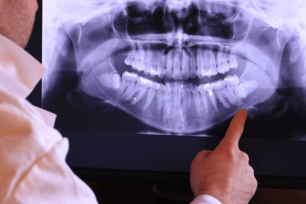 Best Emergency Dentist for Knocked-Out Tooth in Stroud, OK